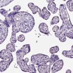 CFAP54 Antibody in Immunohistochemistry (Paraffin) (IHC (P))