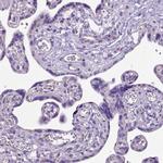 CFAP54 Antibody in Immunohistochemistry (IHC)