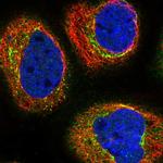 TCTN2 Polyclonal Antibody