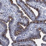 TCTN2 Antibody in Immunohistochemistry (Paraffin) (IHC (P))