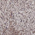 TRMT112 Polyclonal Antibody