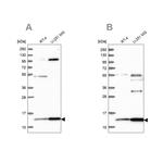 TRMT112 Antibody in Western Blot (WB)