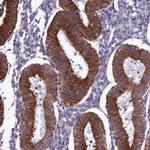 CCDC84 Polyclonal Antibody