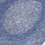 GIF Antibody in Immunohistochemistry (Paraffin) (IHC (P))