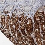 GIF Antibody in Immunohistochemistry (IHC)