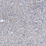 GIF Antibody in Immunohistochemistry (IHC)