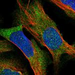 BCDIN3D Polyclonal Antibody