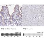 TREH Antibody in Immunohistochemistry (IHC)