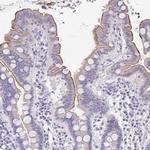 TREH Antibody in Immunohistochemistry (IHC)