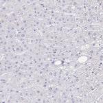 TREH Antibody in Immunohistochemistry (IHC)