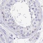 TREH Antibody in Immunohistochemistry (IHC)