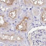 TREH Antibody in Immunohistochemistry (IHC)