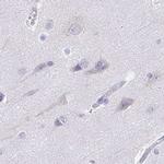 TREH Antibody in Immunohistochemistry (IHC)