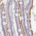 TREH Antibody in Immunohistochemistry (IHC)