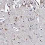 GLB1L3 Polyclonal Antibody