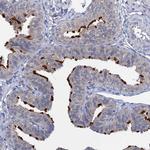 ANKRD42 Antibody in Immunohistochemistry (Paraffin) (IHC (P))