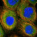 PIGN Polyclonal Antibody