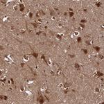 PIGN Antibody in Immunohistochemistry (Paraffin) (IHC (P))