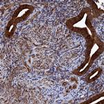 PIGN Antibody in Immunohistochemistry (Paraffin) (IHC (P))