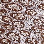 PIGN Antibody in Immunohistochemistry (Paraffin) (IHC (P))