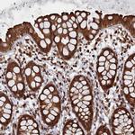 PIGN Antibody in Immunohistochemistry (IHC)