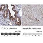 ARHGAP42 Antibody in Immunohistochemistry (IHC)