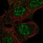 ARHGAP42 Polyclonal Antibody