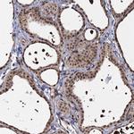 PIGB Polyclonal Antibody