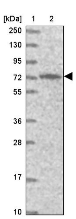 PIGB Antibody in Western Blot (WB)