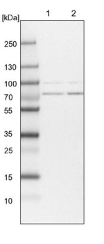 PIGB Antibody in Western Blot (WB)