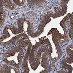 SLC46A3 Antibody in Immunohistochemistry (Paraffin) (IHC (P))