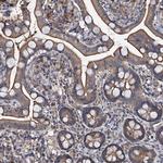 SLC46A3 Antibody in Immunohistochemistry (Paraffin) (IHC (P))