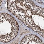 SLC46A3 Antibody in Immunohistochemistry (Paraffin) (IHC (P))