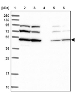 SLC46A3 Antibody in Western Blot (WB)