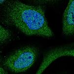 WDR61 Polyclonal Antibody