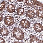 NDUFAF1 Antibody in Immunohistochemistry (Paraffin) (IHC (P))