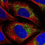 TIMM10 Antibody in Immunocytochemistry (ICC/IF)