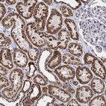 TIMM10 Antibody in Immunohistochemistry (IHC)