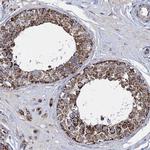 TIMM10 Antibody in Immunohistochemistry (IHC)