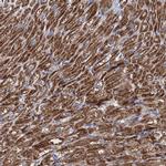 TIMM10 Antibody in Immunohistochemistry (IHC)