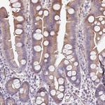 ANO9 Polyclonal Antibody