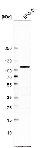 TBCK Antibody in Western Blot (WB)