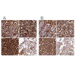 CLYBL Antibody in Immunohistochemistry (Paraffin) (IHC (P))