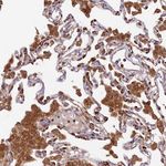 CLYBL Antibody in Immunohistochemistry (Paraffin) (IHC (P))