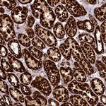CLYBL Antibody in Immunohistochemistry (Paraffin) (IHC (P))