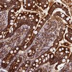 CLYBL Antibody in Immunohistochemistry (Paraffin) (IHC (P))