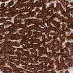 CLYBL Antibody in Immunohistochemistry (Paraffin) (IHC (P))