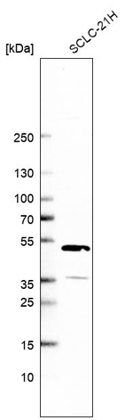 CLYBL Antibody in Western Blot (WB)