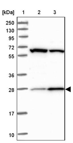 HAUS2 Antibody in Western Blot (WB)