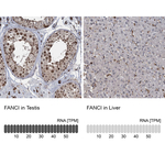 FANCI Antibody in Immunohistochemistry (Paraffin) (IHC (P))